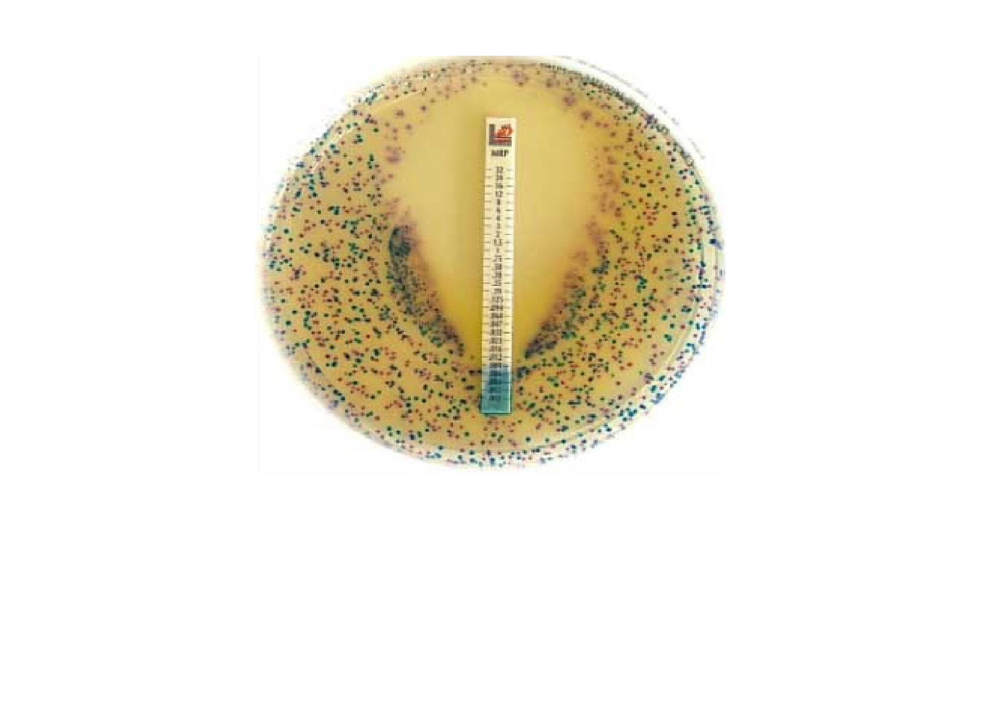 Antimicrobial Susceptibility Testing